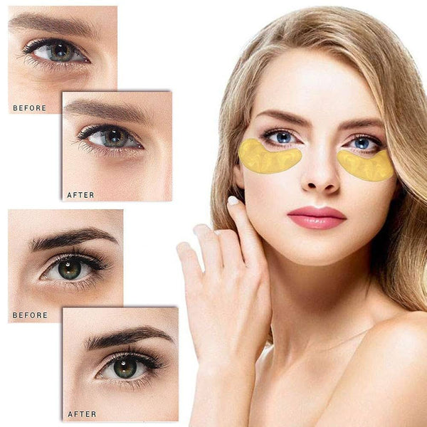 PARCHES DE OJERAS